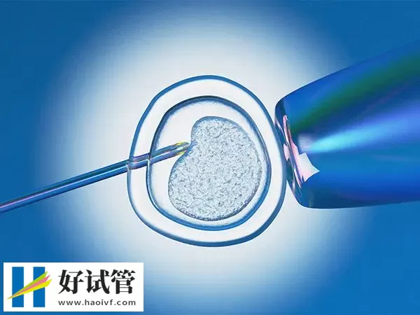 巴中试管婴儿促排5天的雌二醇多少正常(图1) 雌二醇低可能是卵巢早衰导致的