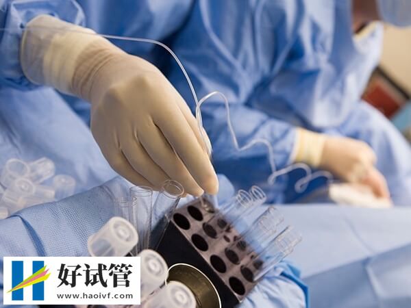 做试管婴儿取卵5个少不少(图1) 取卵多少要看促排方案