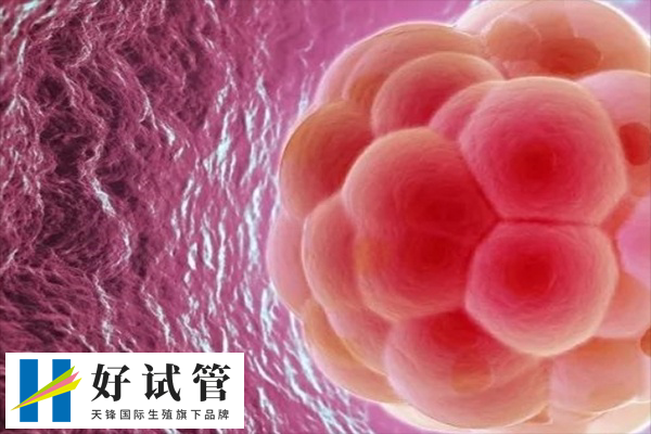 促排期间要定期监测卵泡