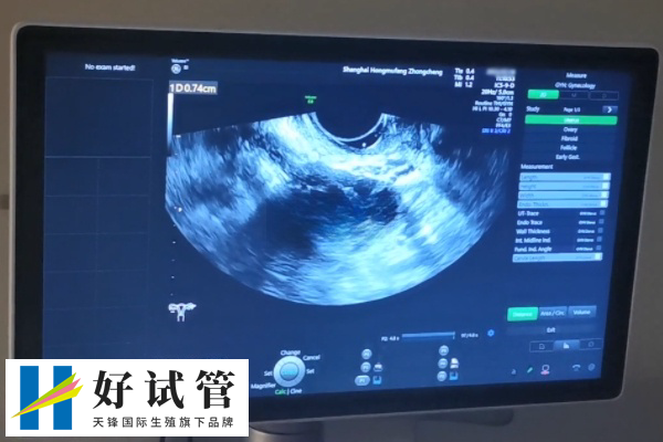 妊娠第30-35天和40-45天进行的阴超检查