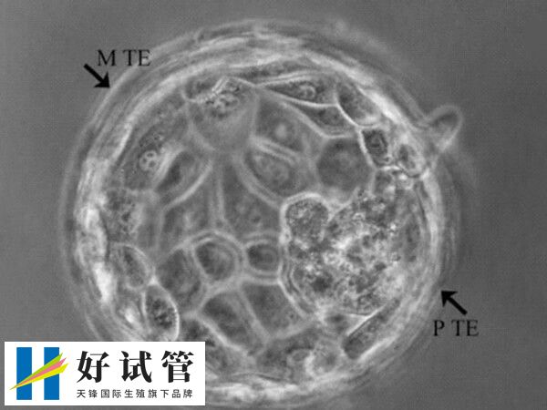 囊胚和子宫内膜的发育周期更加同步
