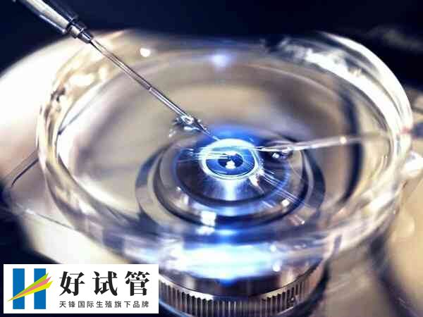 试管婴儿取卵是有创手术