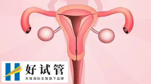 第三代试管婴儿微刺激项目适合哪些人？(图1)