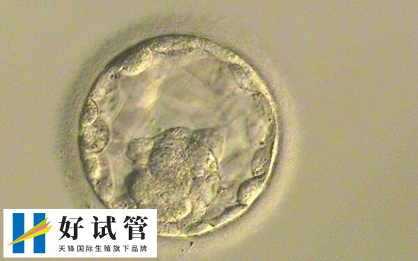 试管囊胚移植失败的原因较多