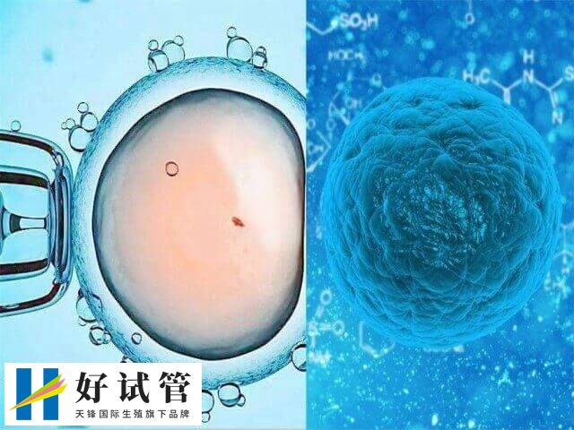 取卵是辅助生殖技术中的一个步骤