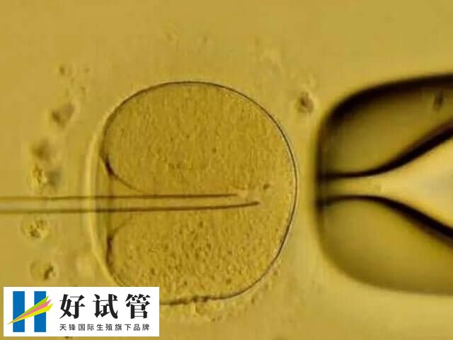 囊胚移植成功率高