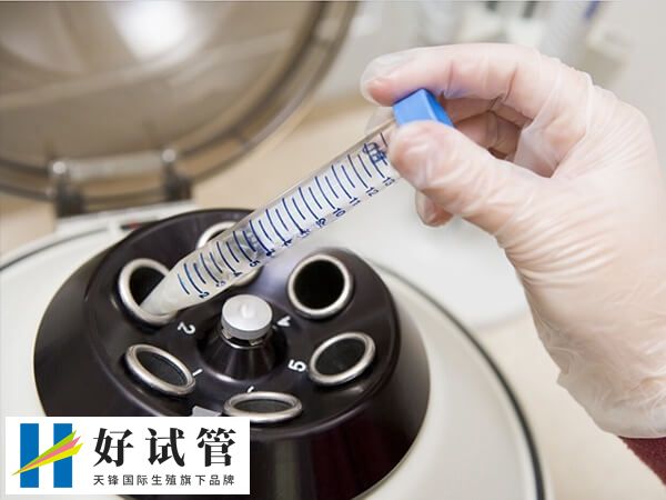 胚胎移植过程大约5-15分钟左右