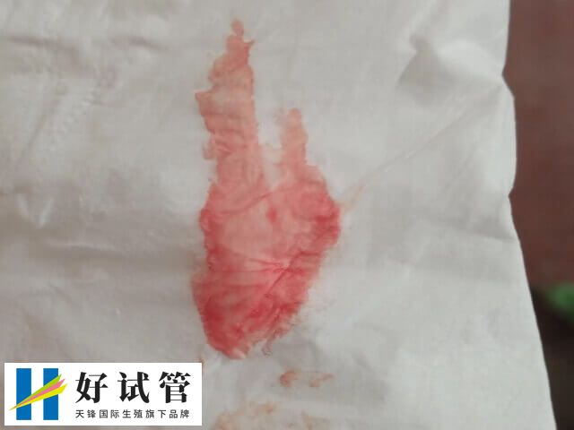 试管移植后出血可能是激素变化所致