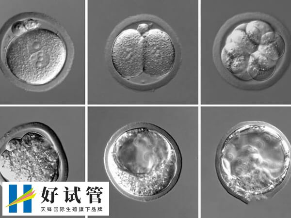 自然绝经的卵巢内卵泡所剩无几
