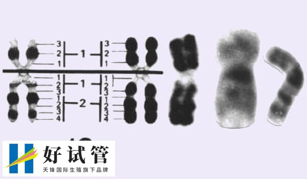 无创提示16号染色体数目偏多不建议留