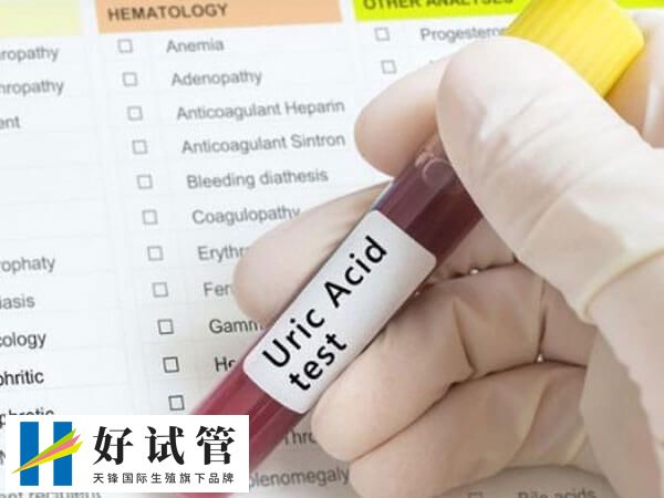 促黄体生成素LH并非越低越好